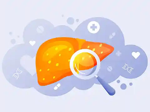 Infografía explicativa con imagen de un hígado saludable y recomendaciones de dieta para mejorar el hígado graso. Nutrición personalizada para salud hepática en Madrid.